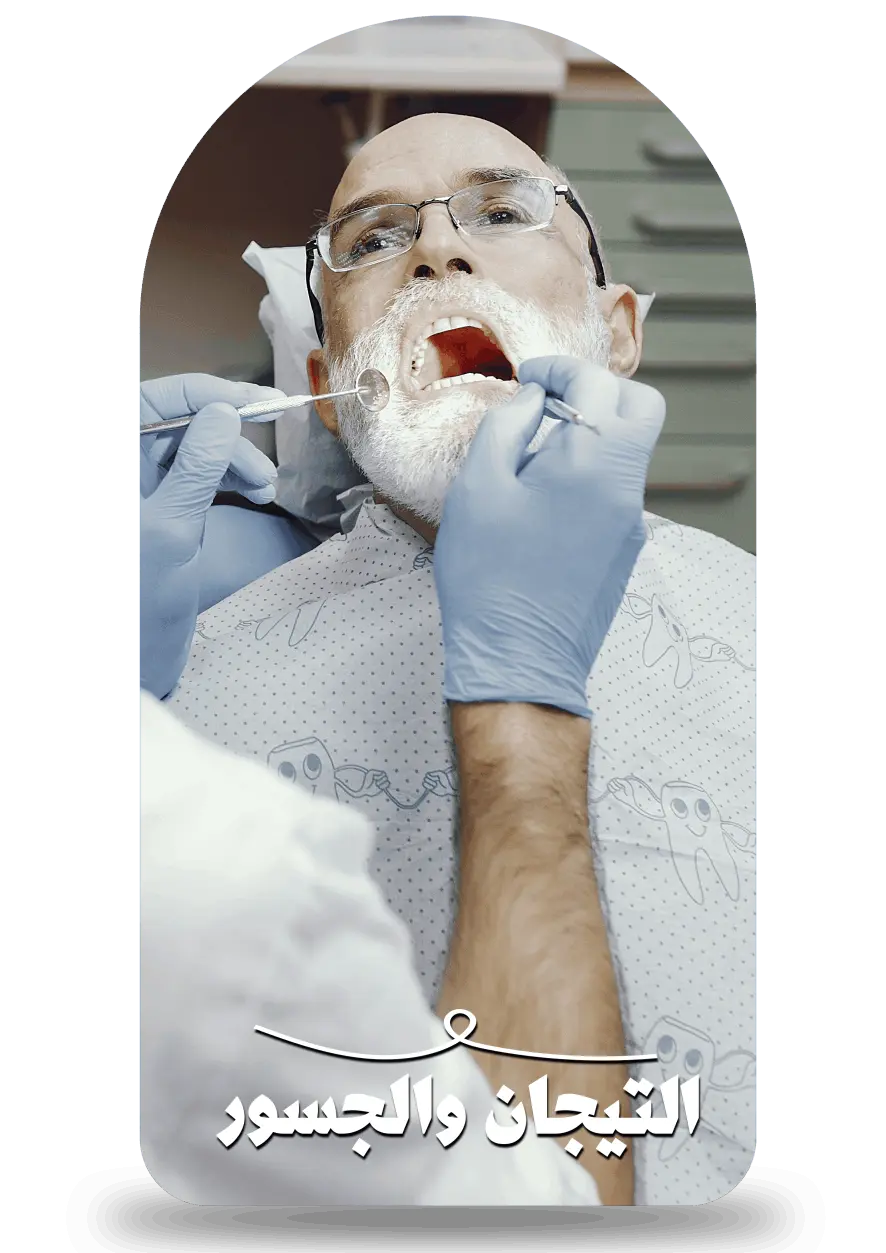 التيجان والجسور